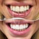 Slider image (9) A-Dent Dental Clinic in Antalya, Turkey